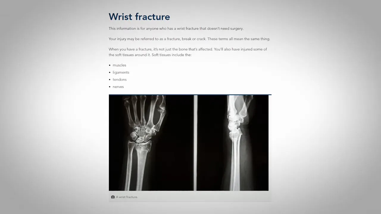 Recovery times information page discussing wrist fracture healing