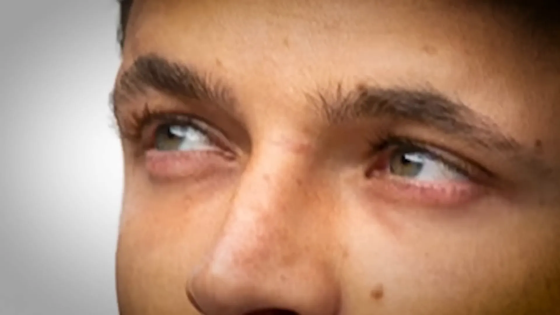Lando Norris' nose injury update